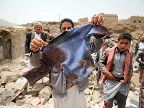8000 یمنی در تجاوز آل سعود شهید شده‌اند