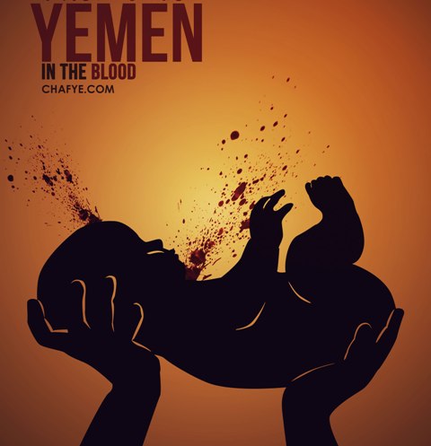 کودک کشی به روش ائتلاف سعود- صهیون