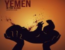 کودک کشی به روش ائتلاف سعود- صهیون کودک کشی به روش ائتلاف سعود- صهیون
