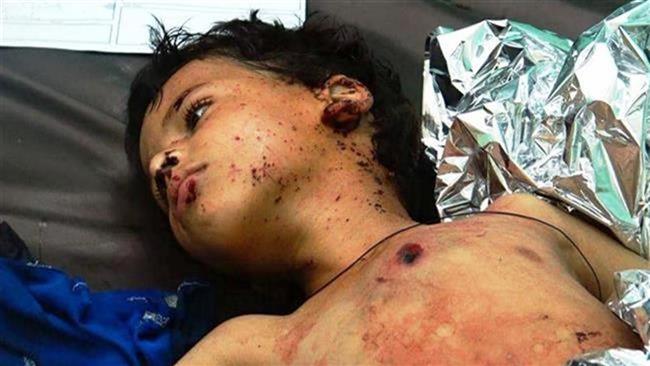 سازمان ملل: 10 هزار کشته در جنگ یمن