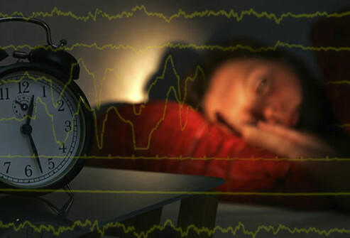 خواب کم باعث سکته مغزی زنان می شود