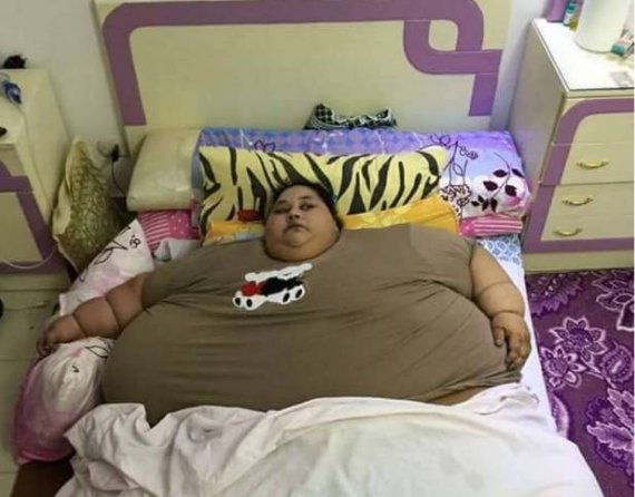 چاق‌ترین زن جهان با 500 کیلو وزن