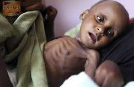 یونیسف: هر ۱۰ دقیقه، یک کودک در یمن می میرد