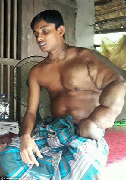دست عجیب جوان بنگلادیشی
