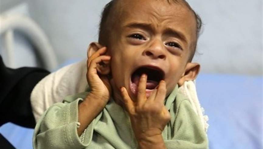 سازمان ملل: 13 ملیون یمنی در معرض قحطی است