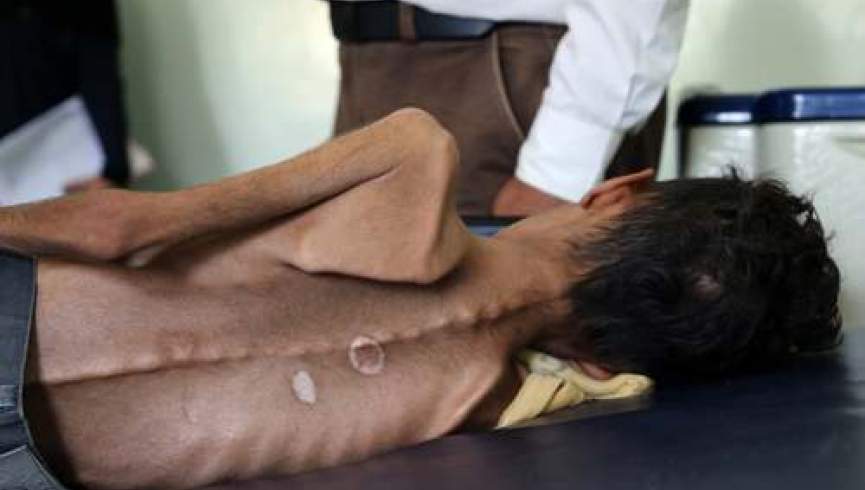 سازمان ملل: یمن امروز جهنم زنده است