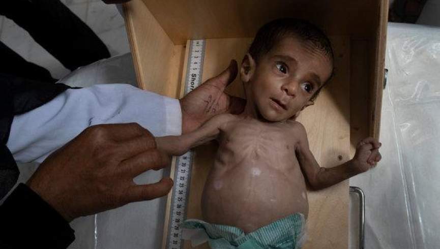22 ملیون نفر در یمن به غذا دسترسی ندارند