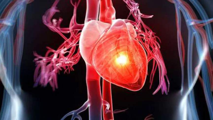 علائم حمله قلبی زنان چقدر متفاوت از مردان است؟