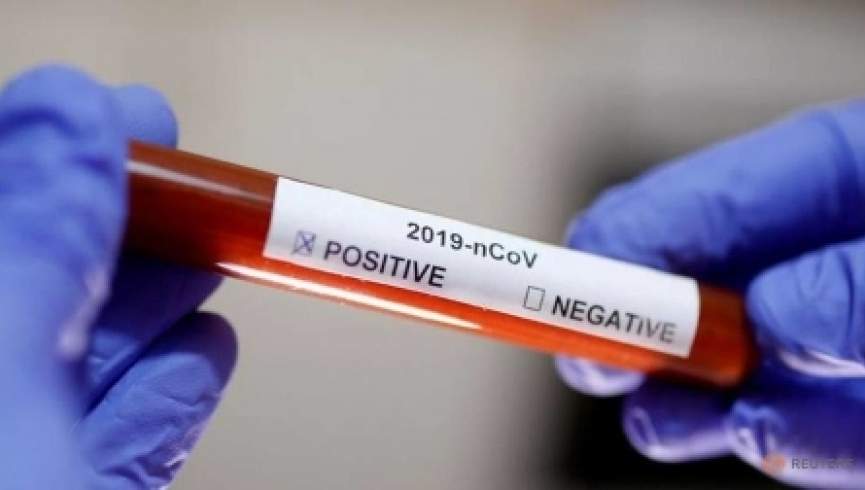 32 رویداد مثبت جدید ویروس کرونا در افغانستان ثبت شد