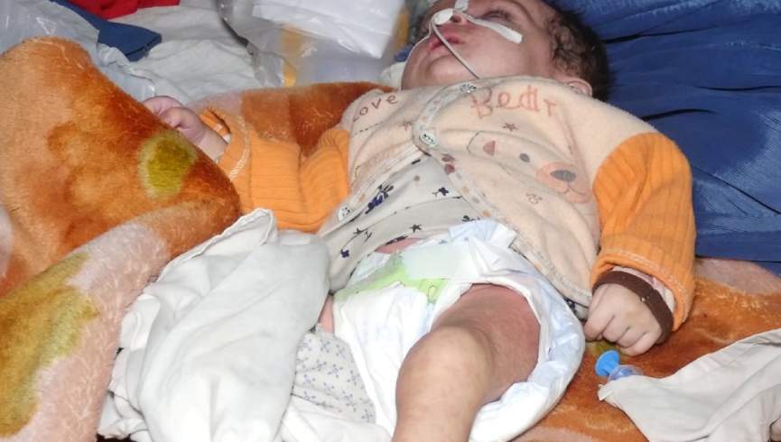 5 هزار کودک مبتلا به سرخکان در افغانستان را بستری کردیم