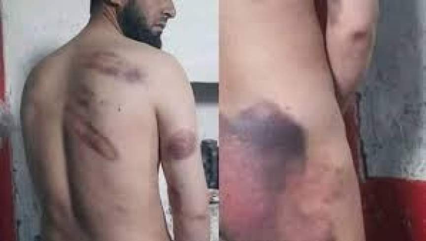 یک داکتر در بدخشان پس از لت و کوب طالبان جان داد